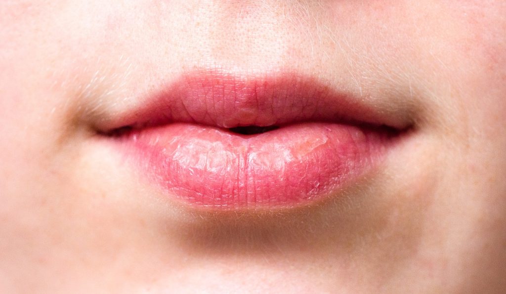 口の中や舌を噛んでしまうのはなぜ?その原因と噛まないようにするための対策